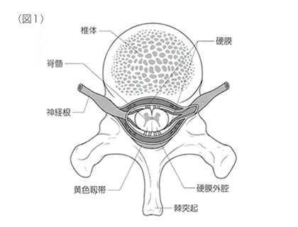 無痛分娩（硬膜外麻酔）の実際1